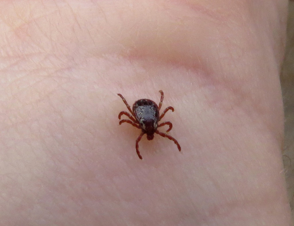 Rocky Mountain spotted fever (RMSF) is a bacterial disease spread through the bite of an infected tick.