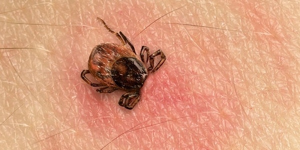 how-do-humans-get-lyme-disease.jpg