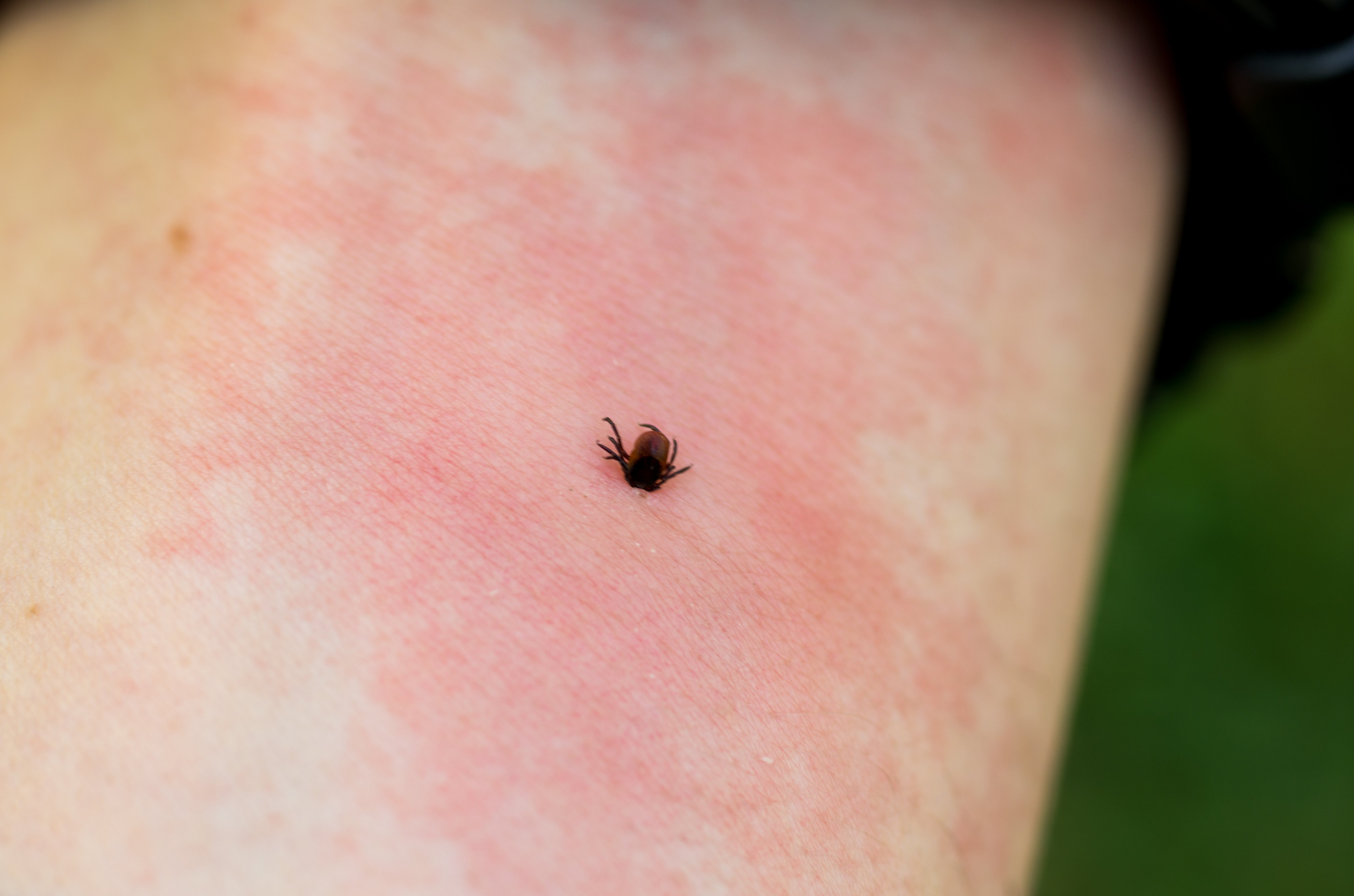 May Is Lyme Disease Awareness Month - Featured Image